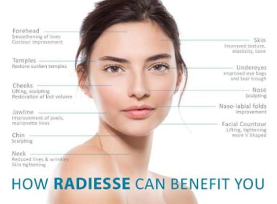 how-radiesse-can-benefit-you-image